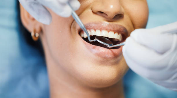 Best Walk-In Emergency Dentist in Lake Barcroft, VA